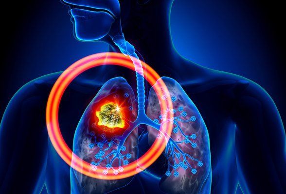 Nedeni Önemli Bir Konu: Sigara ve Tütün Mamulleri